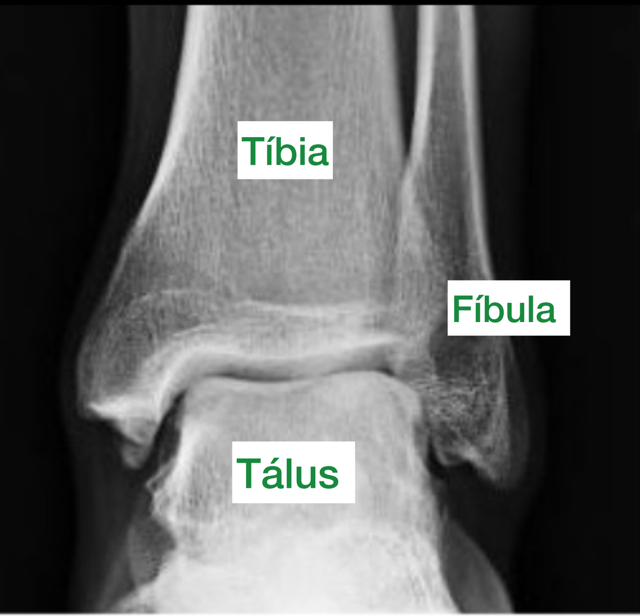 anatomia-do-tornozelo-rx