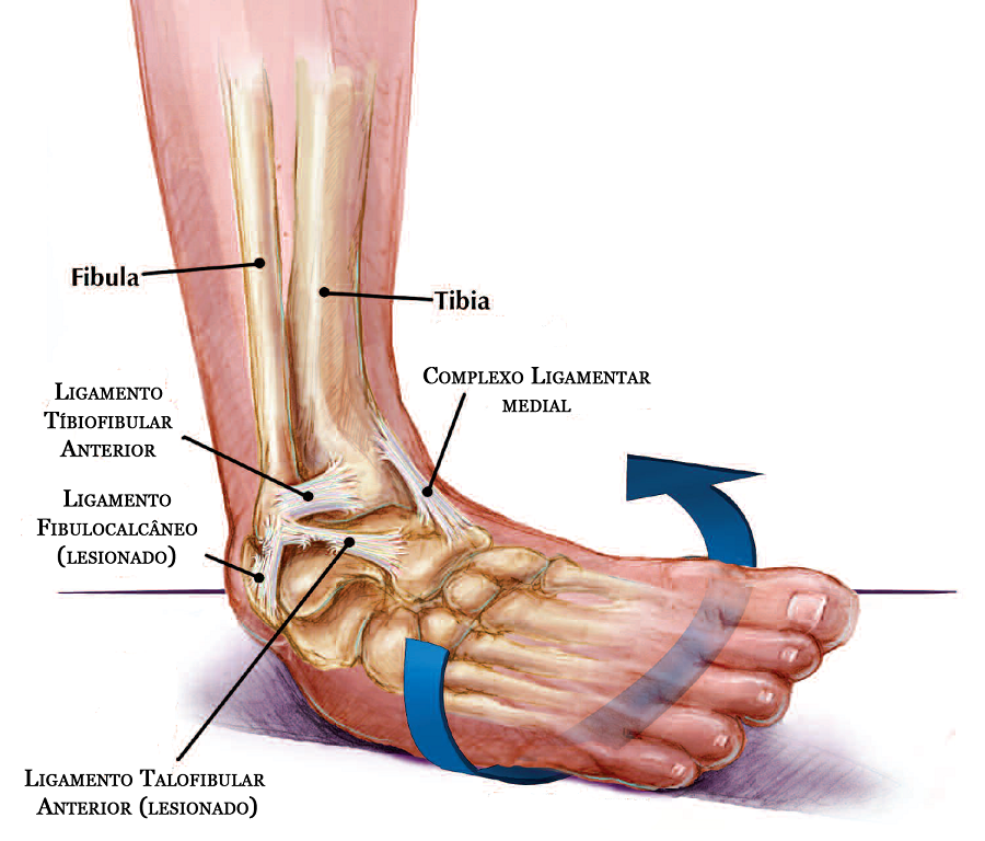 ligamento no tornozelo - imagem mostrando os principais