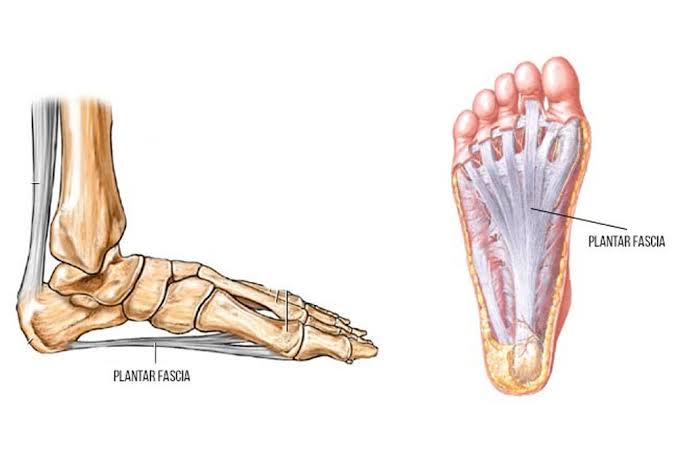 mostrando a fascia plantar, local onde ocorre a formação do esporão calcaneo