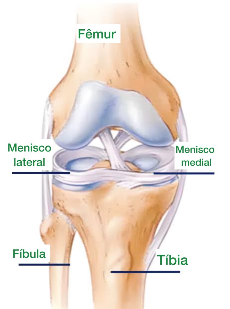 menisco discoide, ilustração de um joelho normal 