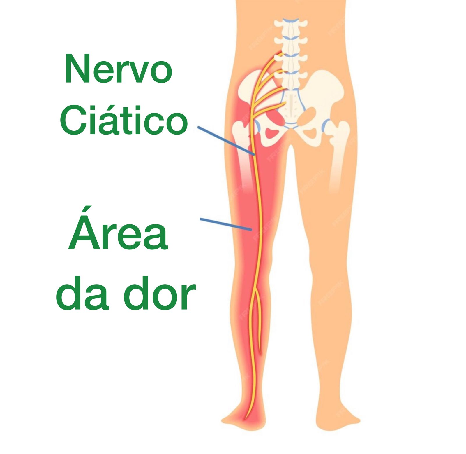 Nervo Ciático: tudo o que você precisa saber - Dr. Thiago Protta