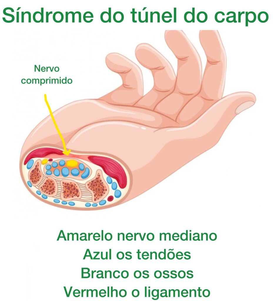 imagem mostrando a localização do nervo mediano e a anatomia ao seu redor.